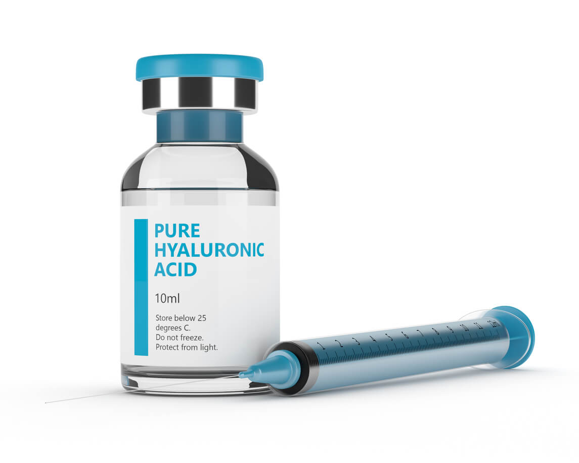 Hyaluron Unterspritzung Nasolabialfalte